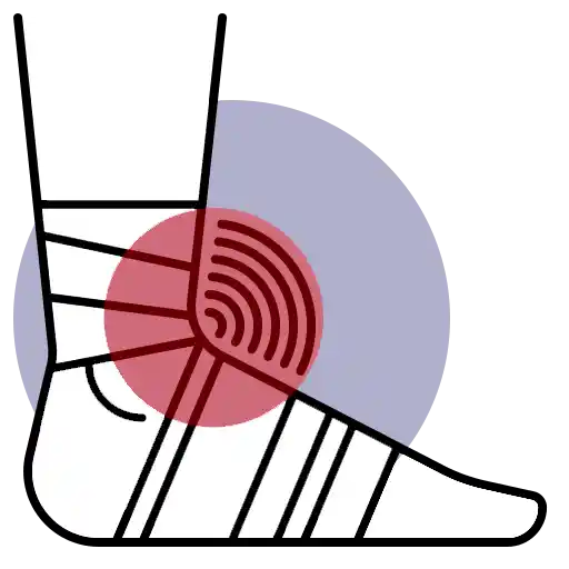 ligament sprains